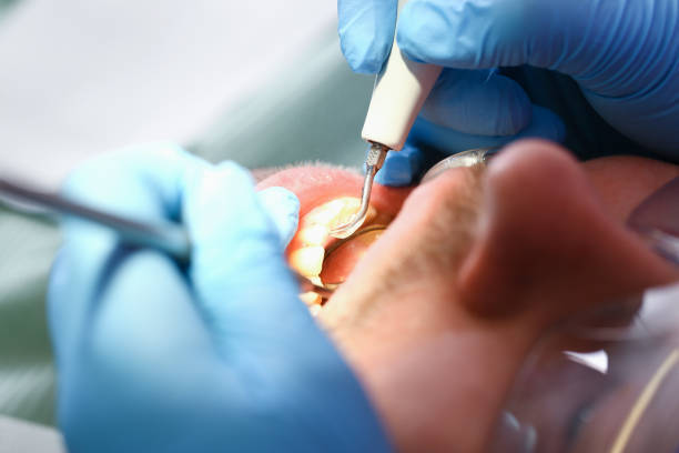 Best Emergency Treatment for Toothache in Bonham, TX