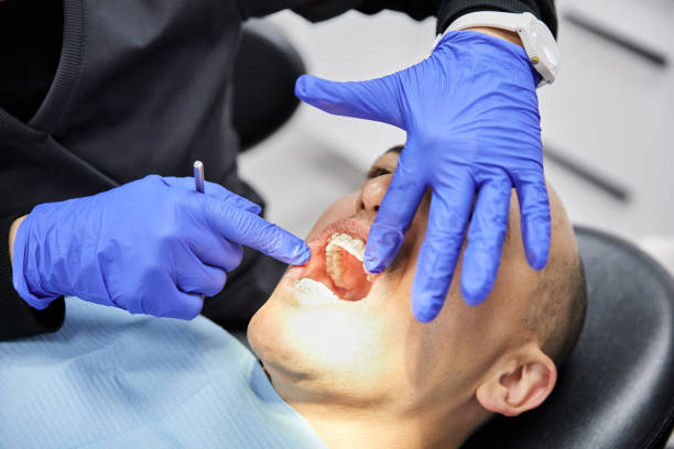 Best Emergency Tooth Extraction in Bonham, TX